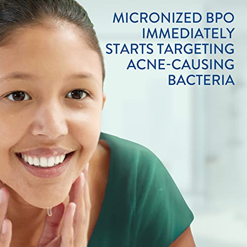 Cetaphil Gentle Clear Complexion Benzoyl Peroxide Acne Face Wash - 4.2 Fl Oz - Bellso