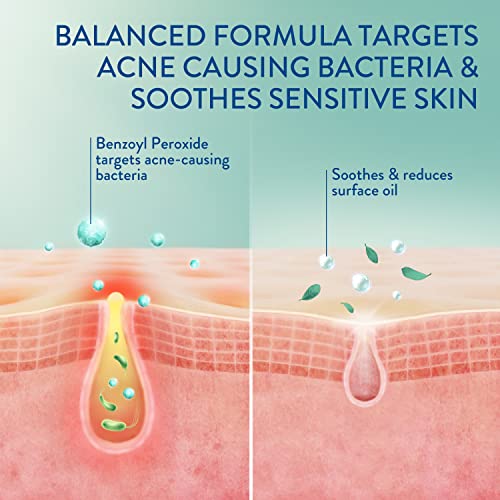 Cetaphil Gentle Clear Complexion Benzoyl Peroxide Acne Face Wash - 4.2 Fl Oz - Bellso