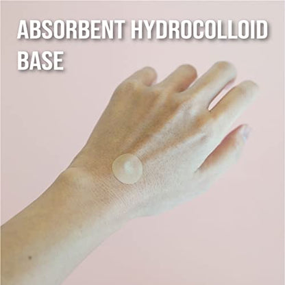 745300 Bug Bite Relief Pouch - 27 Count