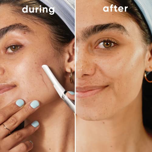 Venus for Facial Hair & Skin Care Exfoliating Dermaplaning Razor Blade Refills - 4ct - Bellso