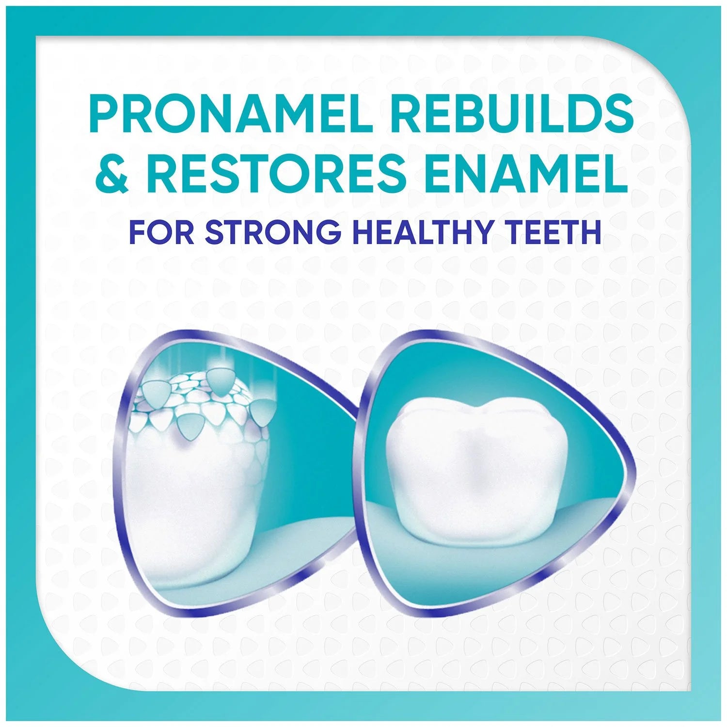 Sensodyne Pronamel Advanced Whitening Toothpaste, 6.5 oz., 4 pk. - Bellso